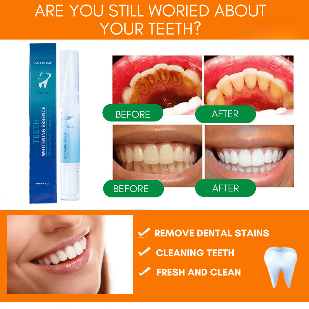 Instant Teeth Whitening Pen | Luxenique