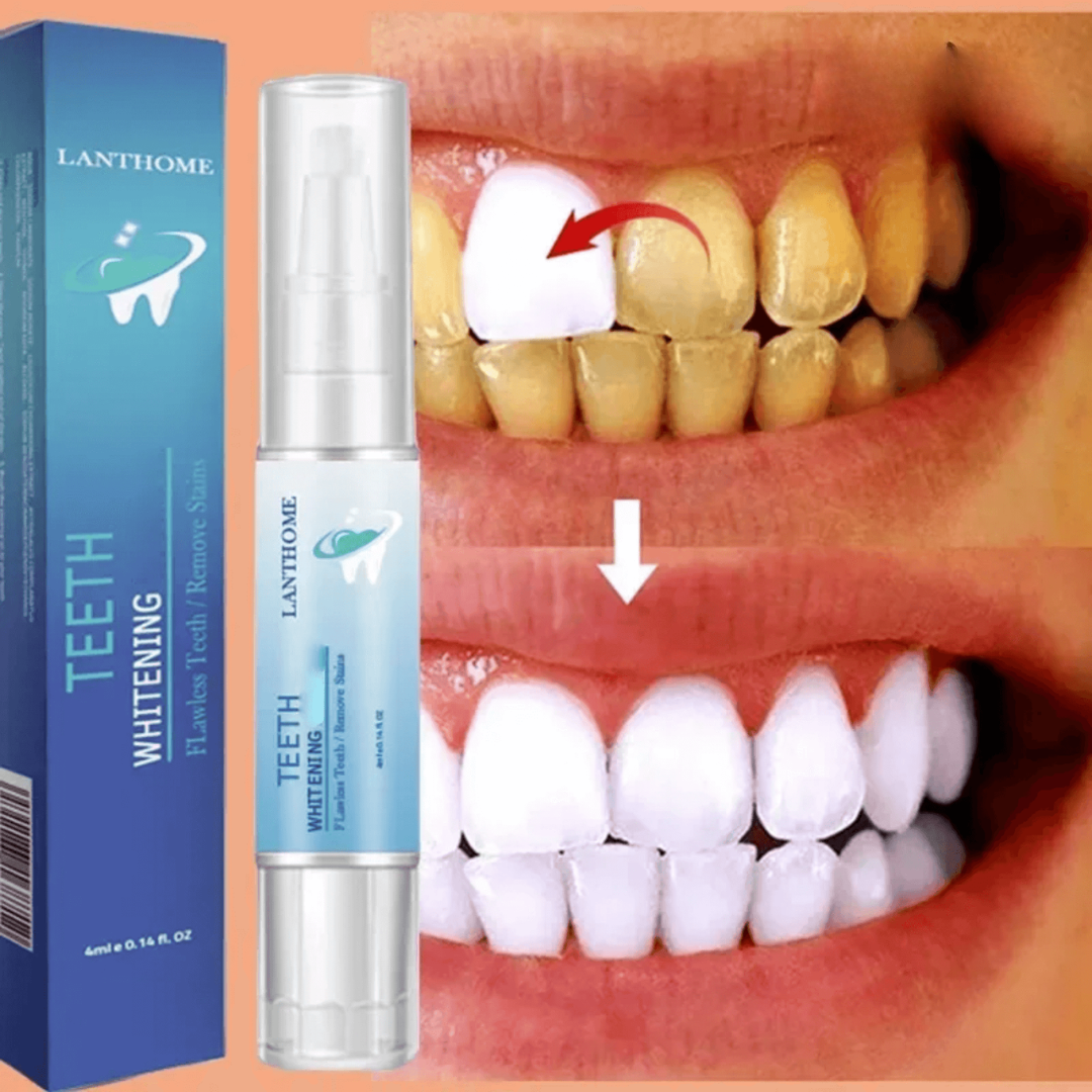 Instant Teeth Whitening Pen | Luxenique
