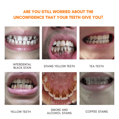 Instant Teeth Whitening Pen | Luxenique