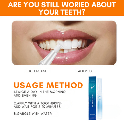Instant Teeth Whitening Pen | Luxenique